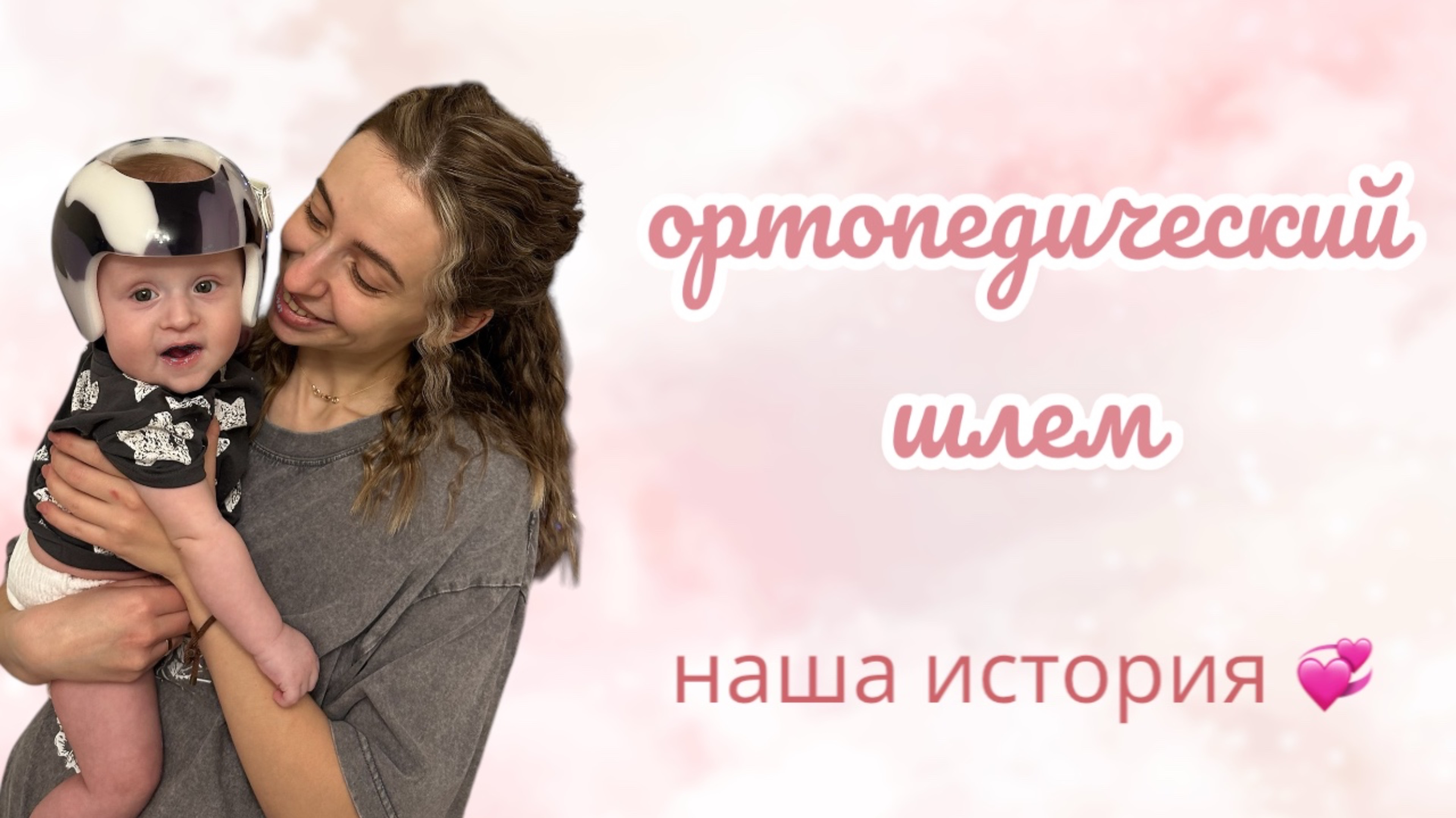 ОРТОПЕДИЧЕСКИЙ ШЛЕМ // НАША ИСТОРИЯ // ПЛАГИОЦЕФАЛИЯ