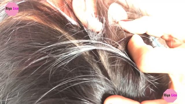 Remove Thousands Of Nits Remove Lice Getting Lice  All From Long Hair