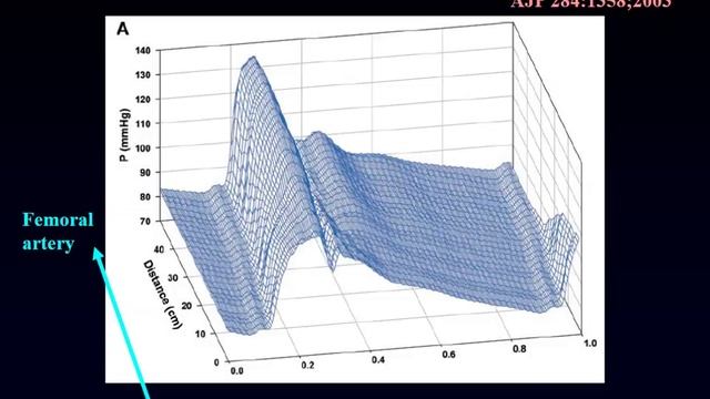 Cardiac output Measurements and interpretation De Backer Daniel