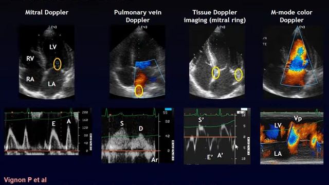 A critical role for echocardiography De Backer Daniel