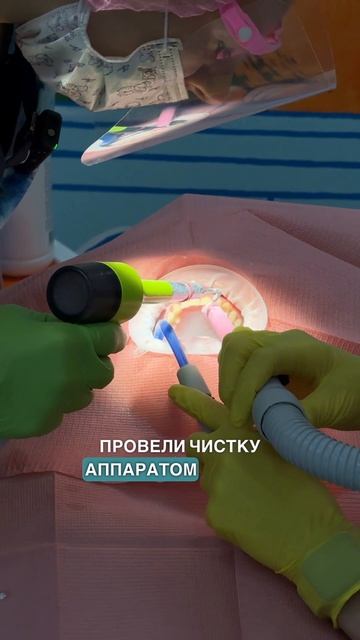 Как проходит проф. гигиена у стоматолога ?
