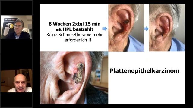 Bioptron Webinar: Die Systemische Heilung mit Bioptron, 17.10.2019