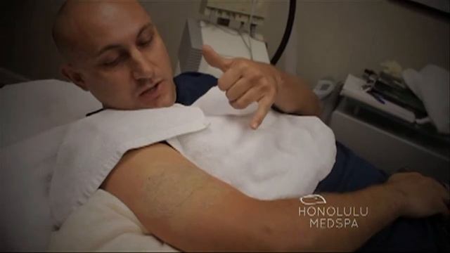 PicoSure Laser Tattoo Removal At Honolulu MedSpa