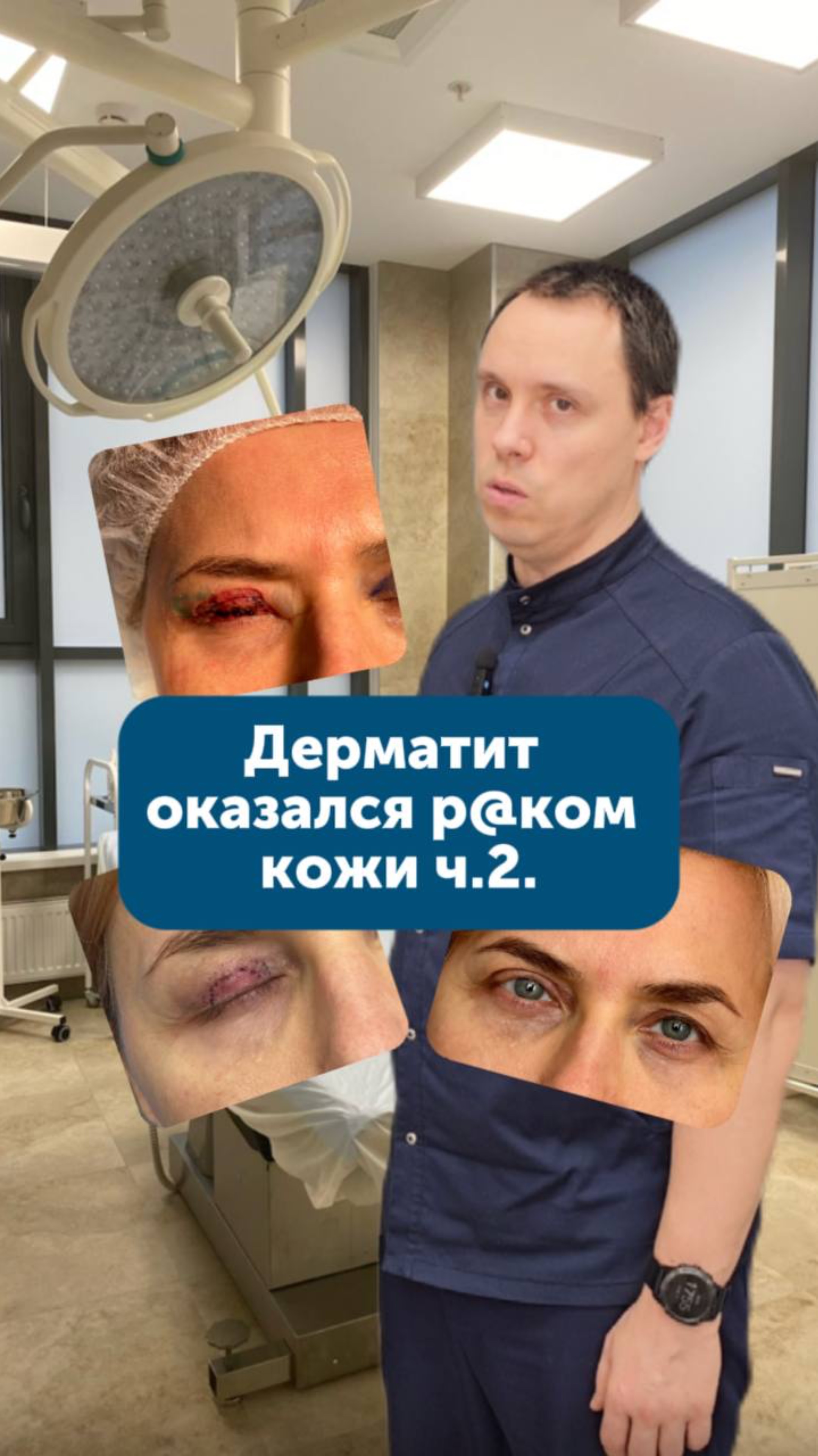 Дерматит оказался 🦞 кожи ч. 2