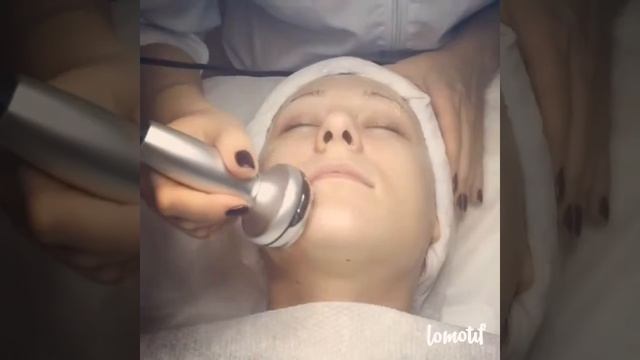 Узи чистка лица, Лифтинг