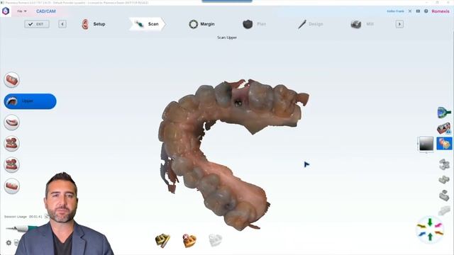 Digital Workflow for Screwmentable Restorations