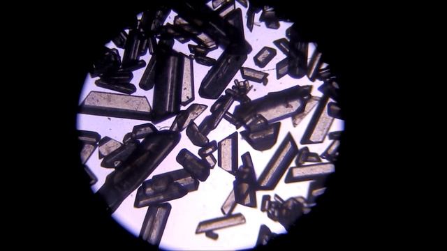 Kryształki struwitu pod mikroskopem/ Struvite crystals under the microscope