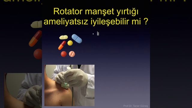 Ortopedi’de sıkça sorulan sorular, Rotator manşet yırtıkları