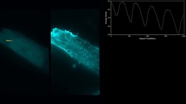Клетки сердца - визуализация с помощью модуля X-Light V2 CrestOptics