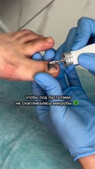 Ещё больше о здоровье ногтей у нас на канале 📲 ПОДПИСЫВАЙТЕСЬ ✔️