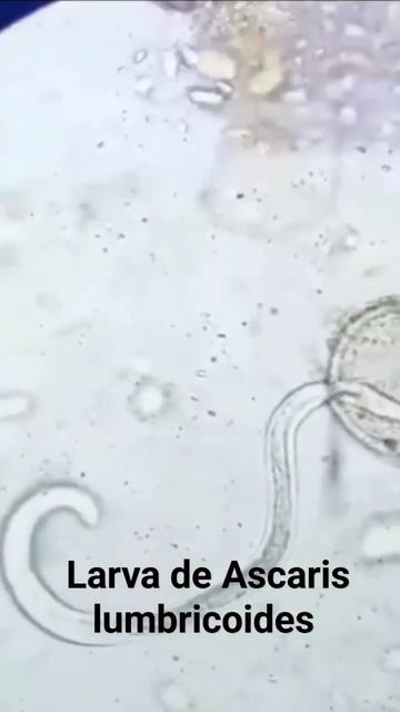 Larva de Ascaris lumbricoides