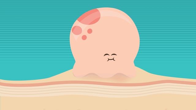 POLYSPORIN: Cold Sore Life Cycle