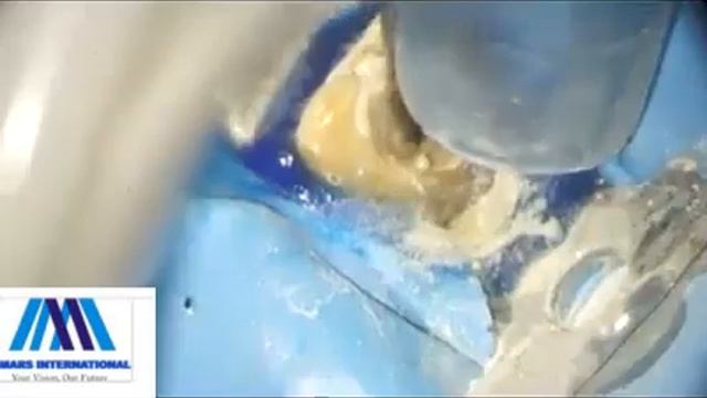 Mars International Dental Surgical Microscopes