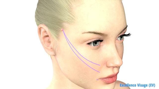 Excellence Visage EV