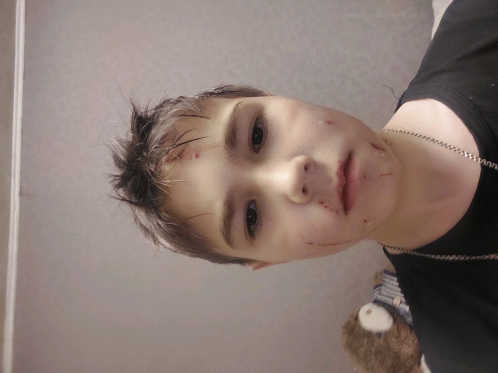 меня поцарапал мой кот кеша