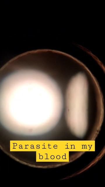 Microscope view of parasite in blood @Oneminmicro @battleofmath#microscope