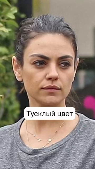 нехватка витамина С