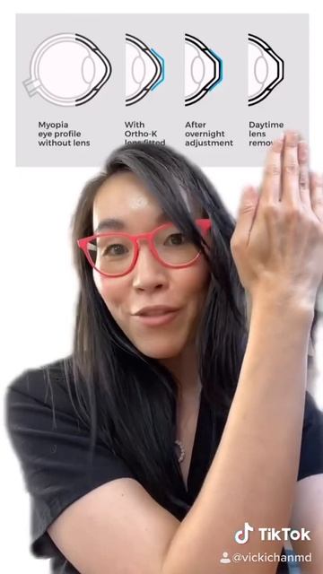 What is Ortho K (Orthokerarology)? by Vicki Chan MD