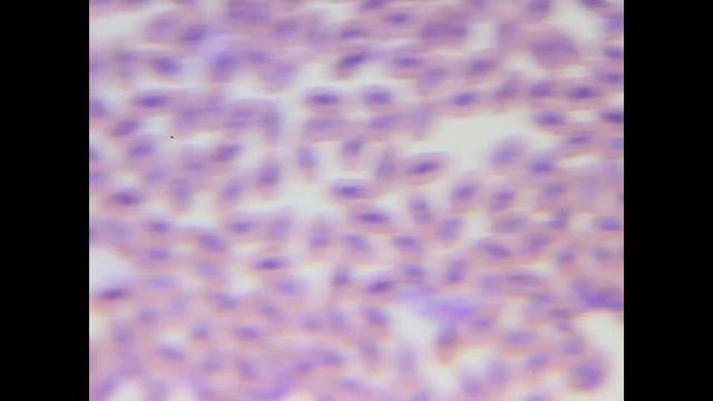Pigeon Blood Under Microscope (bright, Phase, Romanovsky)