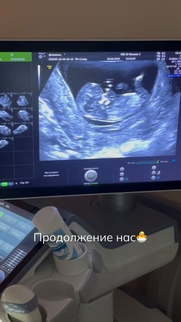 Даже не верится, что это все произошло с нами #любовь #отношениявбраке #беременность #беременная