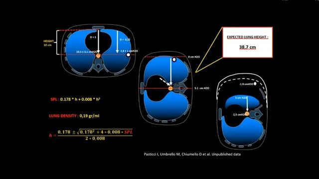 Transpulmonary pressure and lung volumes Luciano Gattinoni 2019