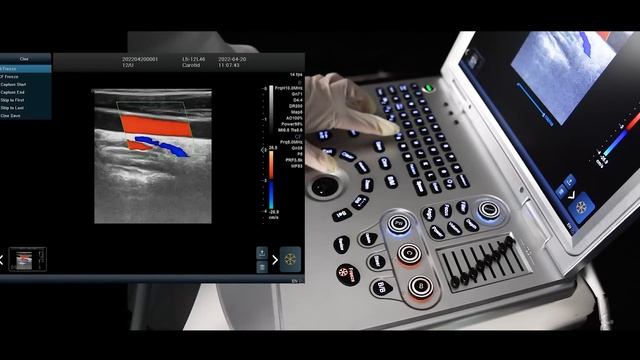 How to use color Doppler and pulse Doppler on ultrasound？