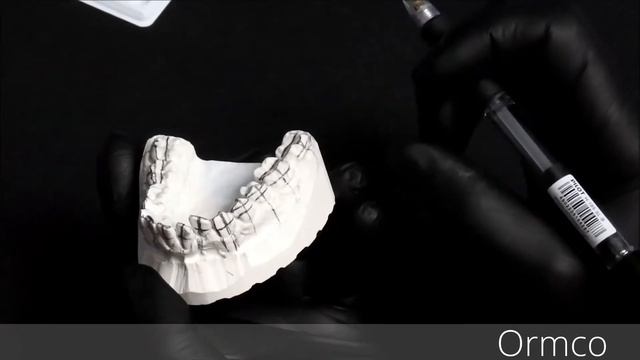 Позиционирование брекетов на гипсовой модели, изготовление каппы для непрямой фиксации