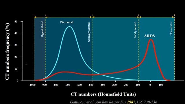 Transpulmonary pressure and lung volumes Gattinoni L 2017