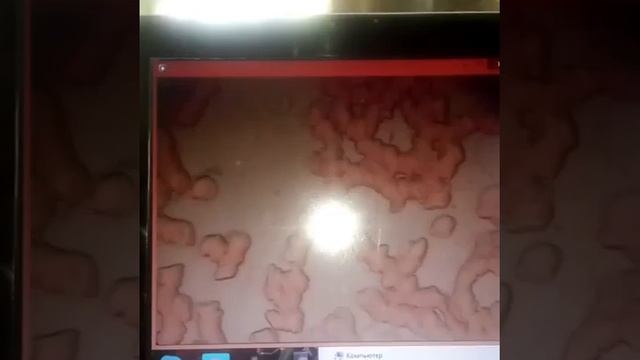 Через пол часа после приема кораллового кальция Беверли