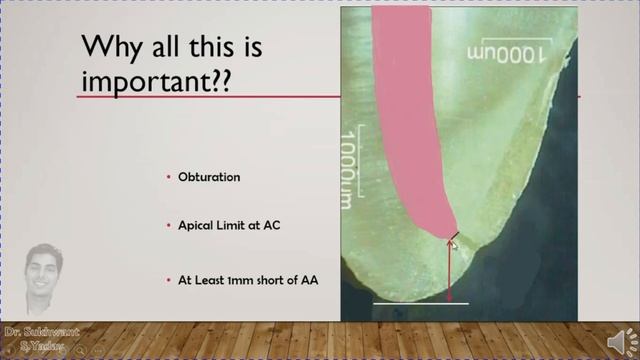 Root Apex - Endodontics Apical Constriction and Apical Foramen