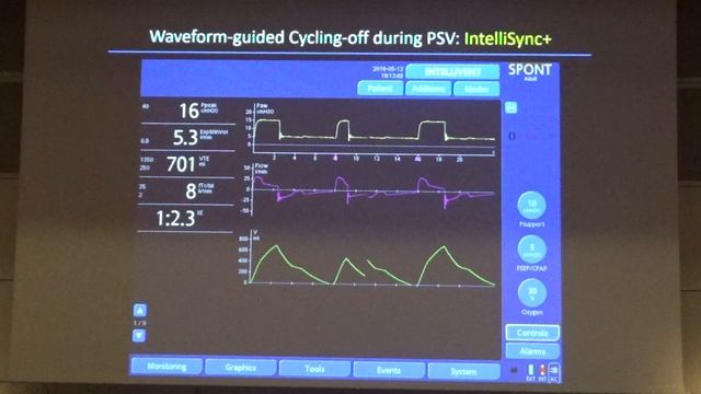 Ventilator waveforms to detect, treat and prevent  Francesco Mojoli