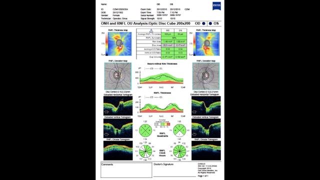 Интерпретация отчетов ОКТ дисков зрительных нервов — Панфилова А.Н.