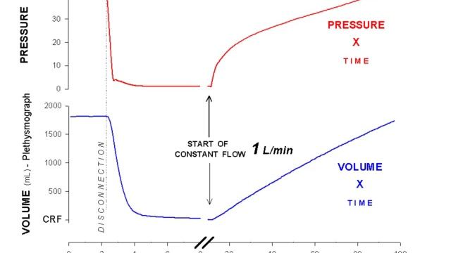 Should we always use CT to customize our mechanical ventilation strategy pro M Amato 2011