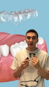 Как работают элайнеры