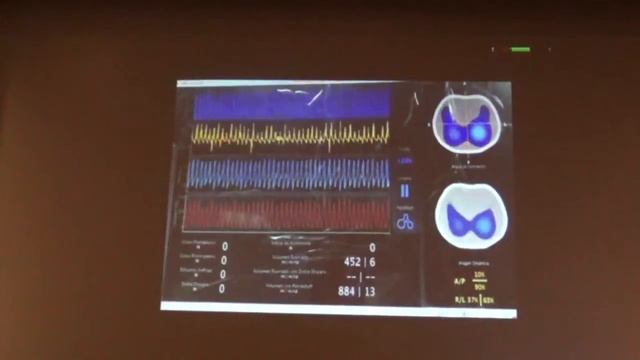 Electrical impedance tomography Marcelo Amato