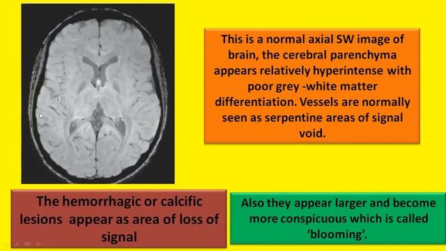 BASIC INTERPRETATION OF MRI SEQUENCES -PART 2 | NEET PG RADIOLOGY | MBBS | RESIDENTS | PHYSICIANS