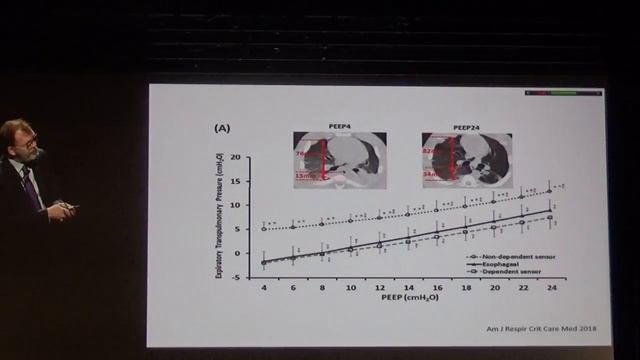 Esophageal pressure What does it really measure Laurent Brochard 2018