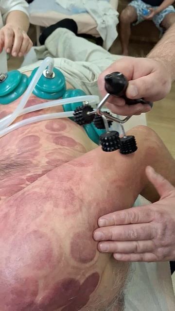 ЭБОНИТОВЫЕ МАССАЖЕРЫ
Вакуумные висцеральные свечи
Деревянная палочка для самомассажа
#shorts