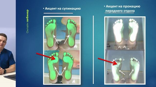 Как устранить Вальгус