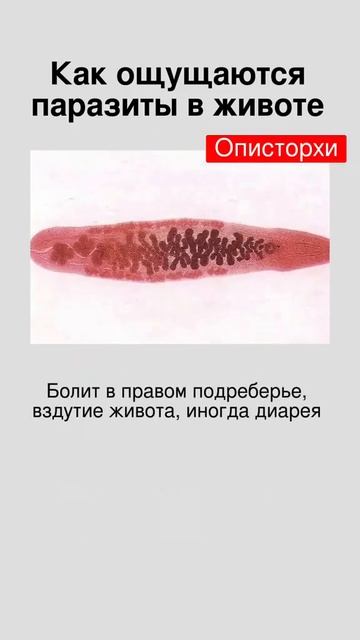Паразиты Нано бальзам 89177376793 консультация Глобал Тренд