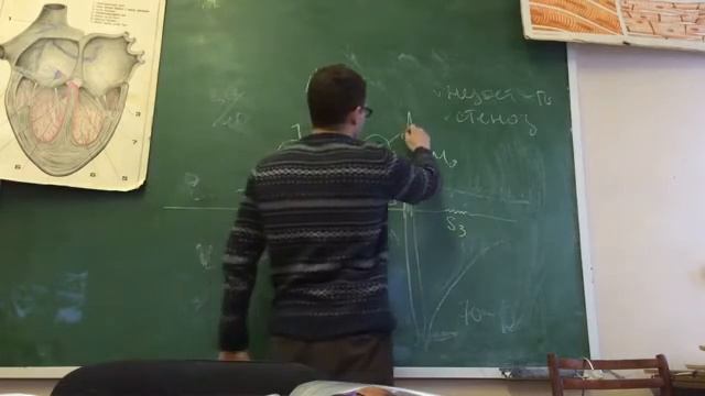 ЭКГ  Часть 5