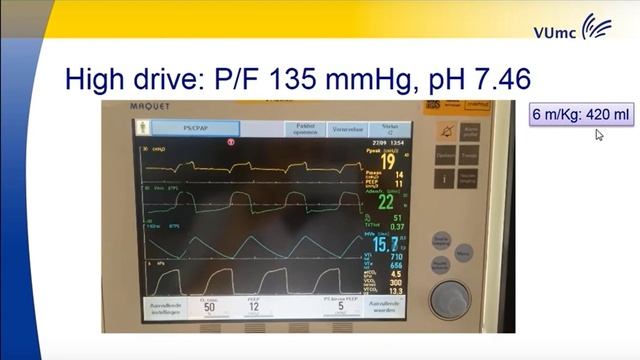 Personalized ventilation can we let physiology take control Leo Heunks 2016