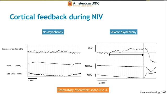 Three physiological concepts I consider most important Leo Heunks 2020