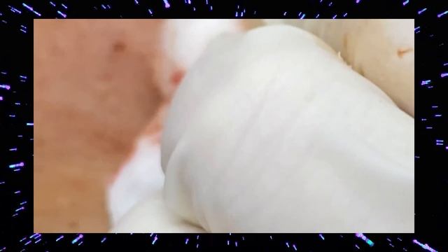 Давим жирные глубокие угри на лице юноши