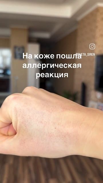 Руки после ПЕРВИЧНОГО удаления обсыпает в 8 случая из 10 - это норма и ваш мастер должен вас предупр