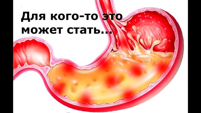 жвачка