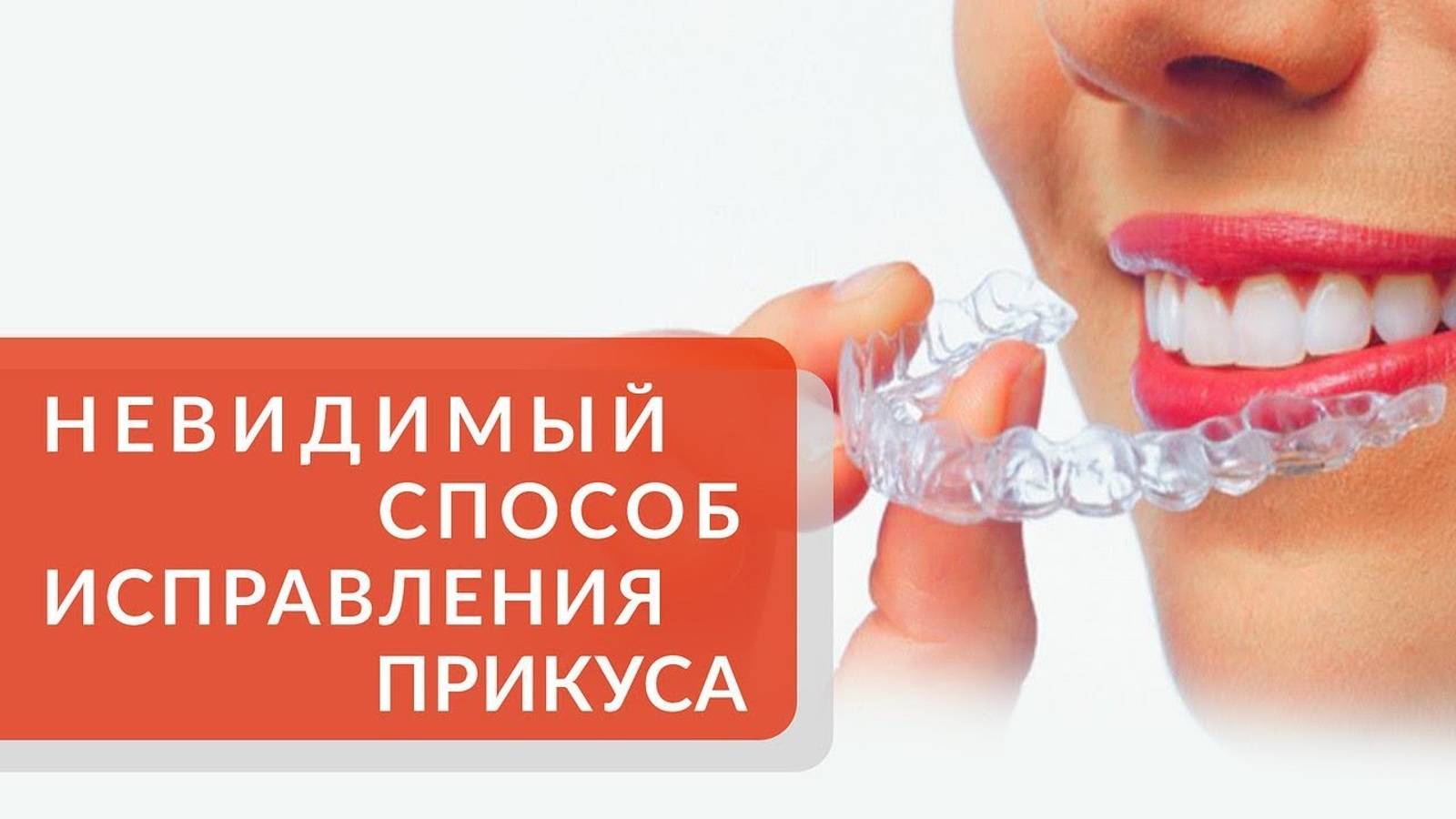Исправление прикуса: комфортно и незаметно с помощью элайнеров. Невидимые элайнеры. Симпладент. 12+