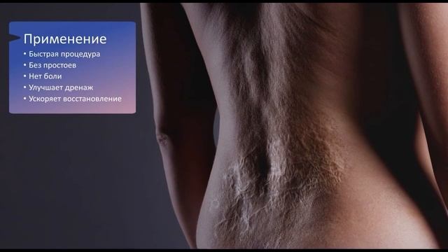 "При применении системы INDIBA Care, я заметила потрясающий результаты"