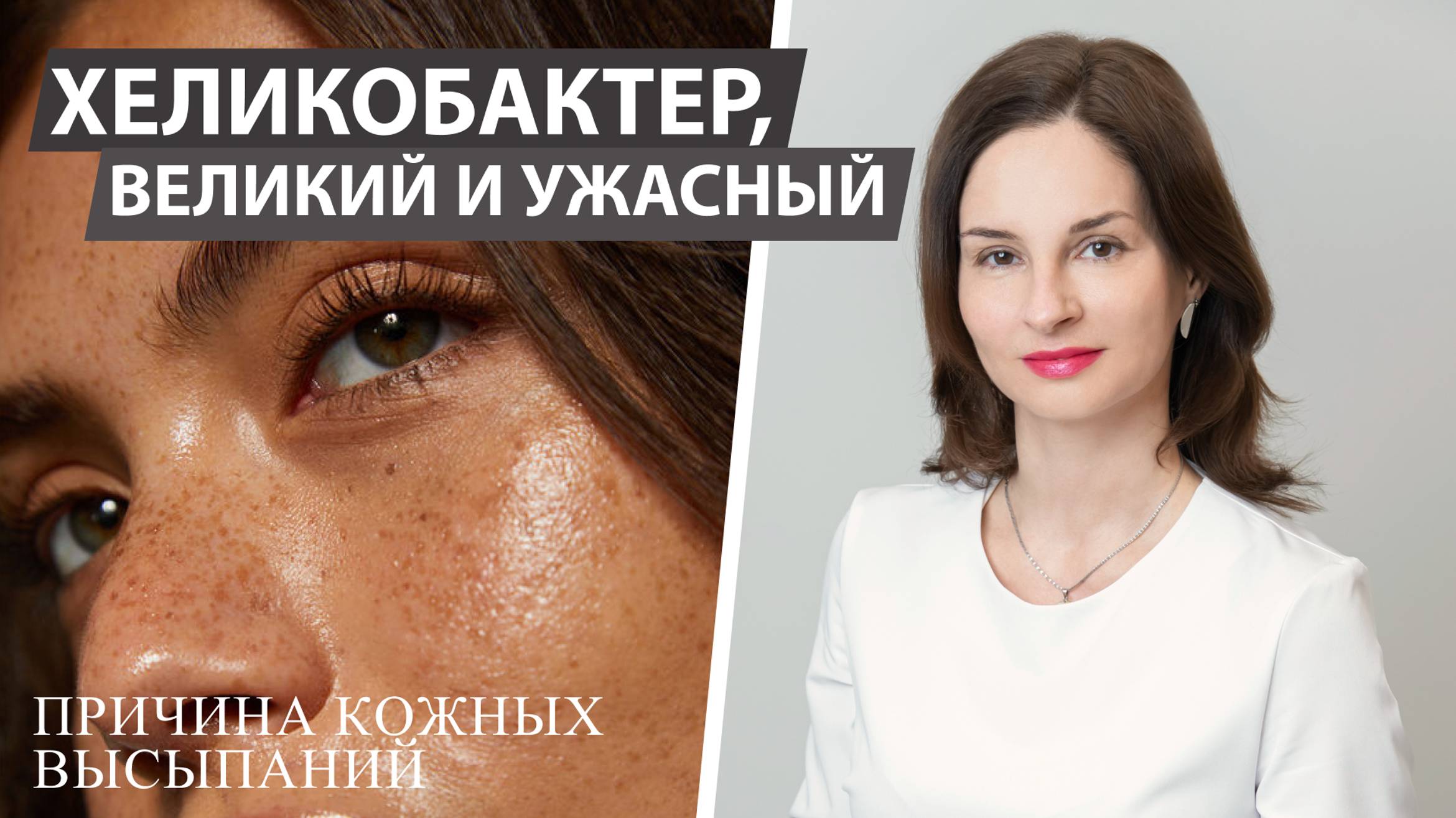 ЧТО ТАКОЕ ХЕЛИКОБАКТЕРИОЗ ?