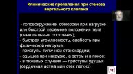 Аортальные пороки 2022 Часть 1 Соколов